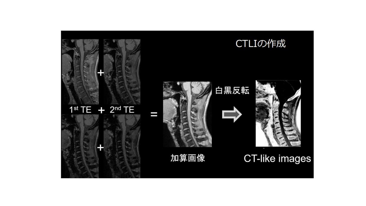 CTLIの特徴